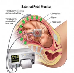 fetal heart rate magetwo