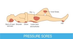 pressuresores